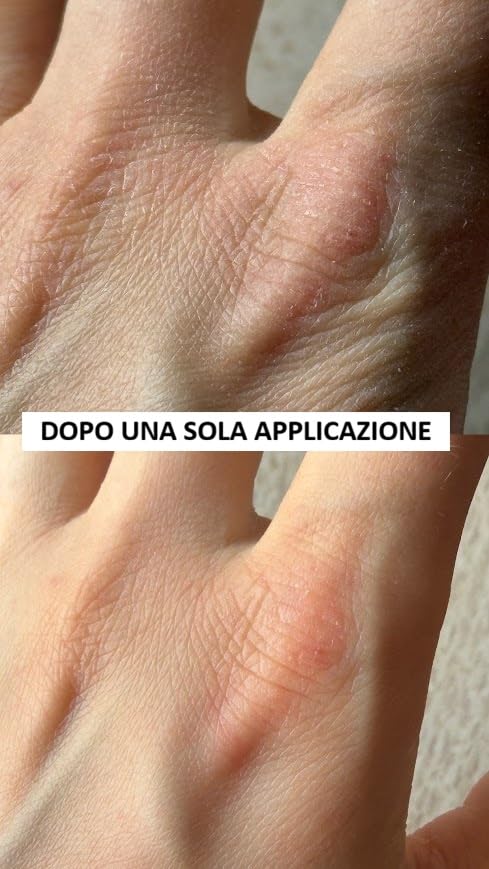 Salva mani screpolate