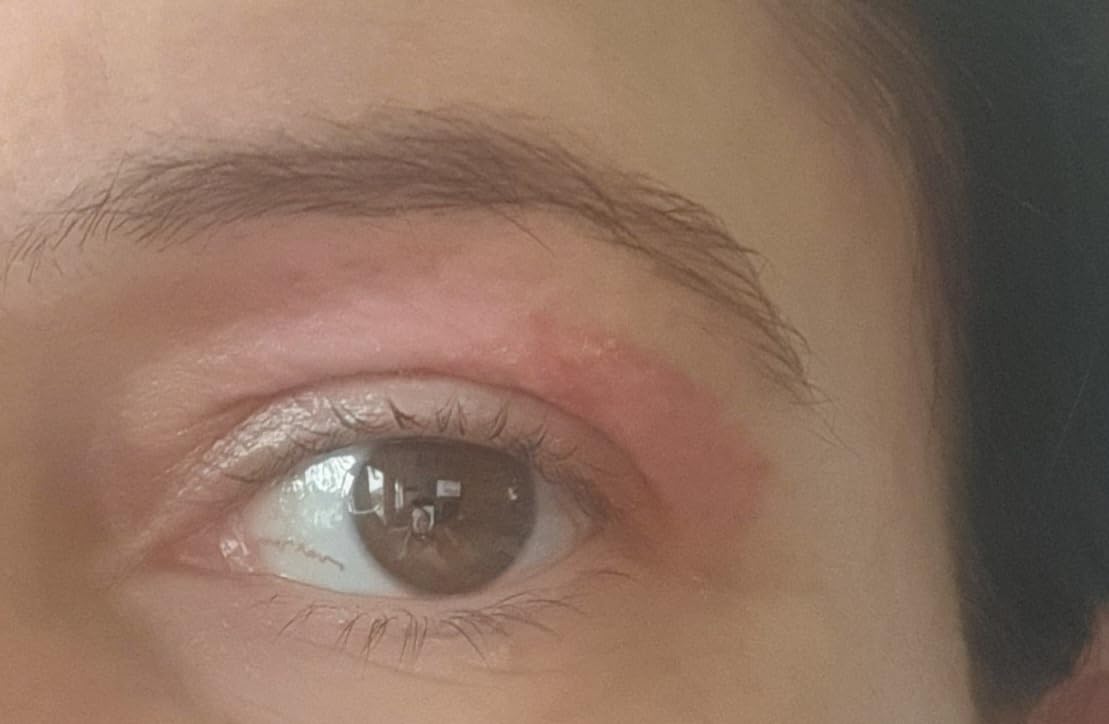 Eccellente per pelli irritate