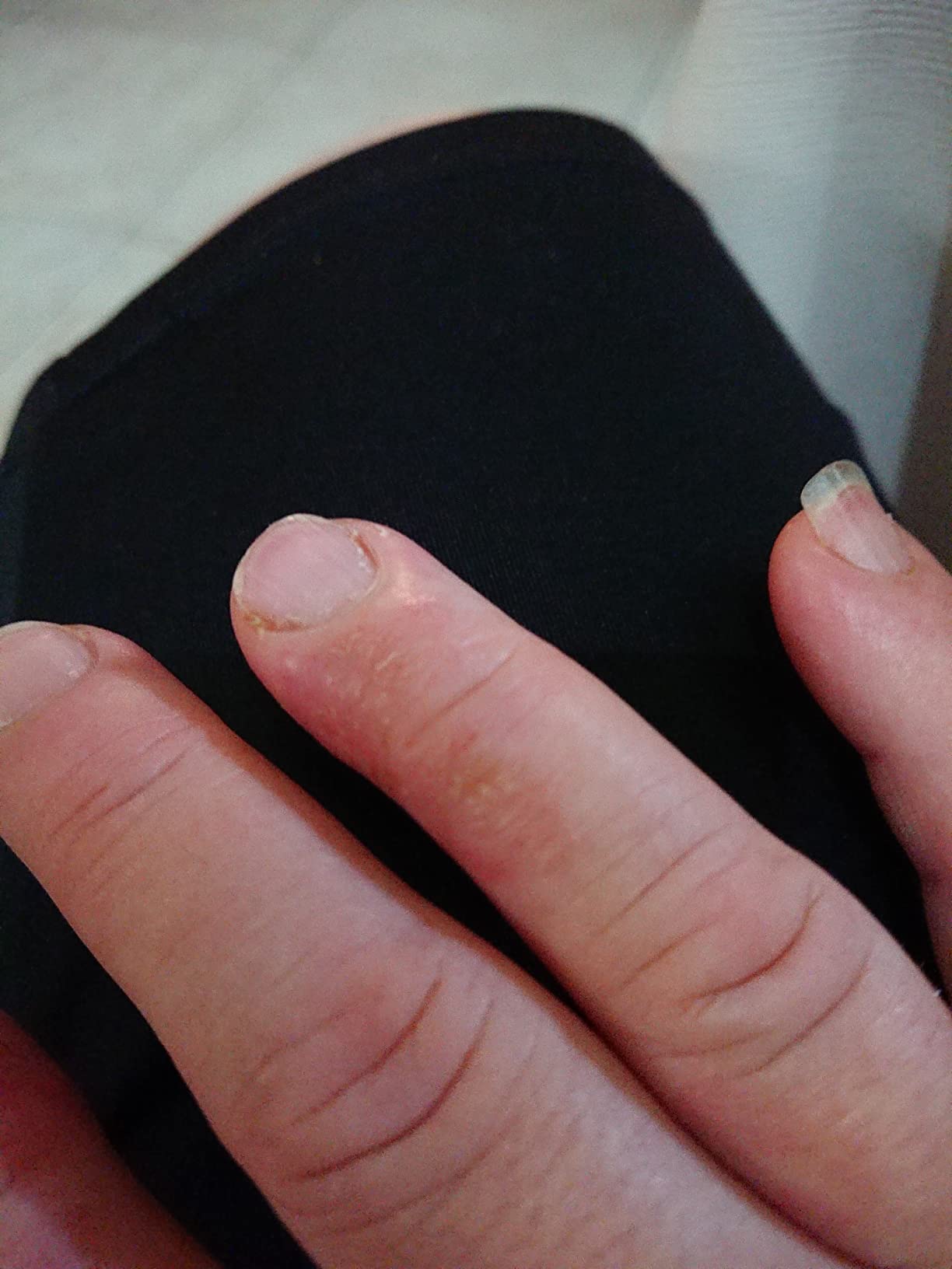 Consigliata dalla mia dermatologa