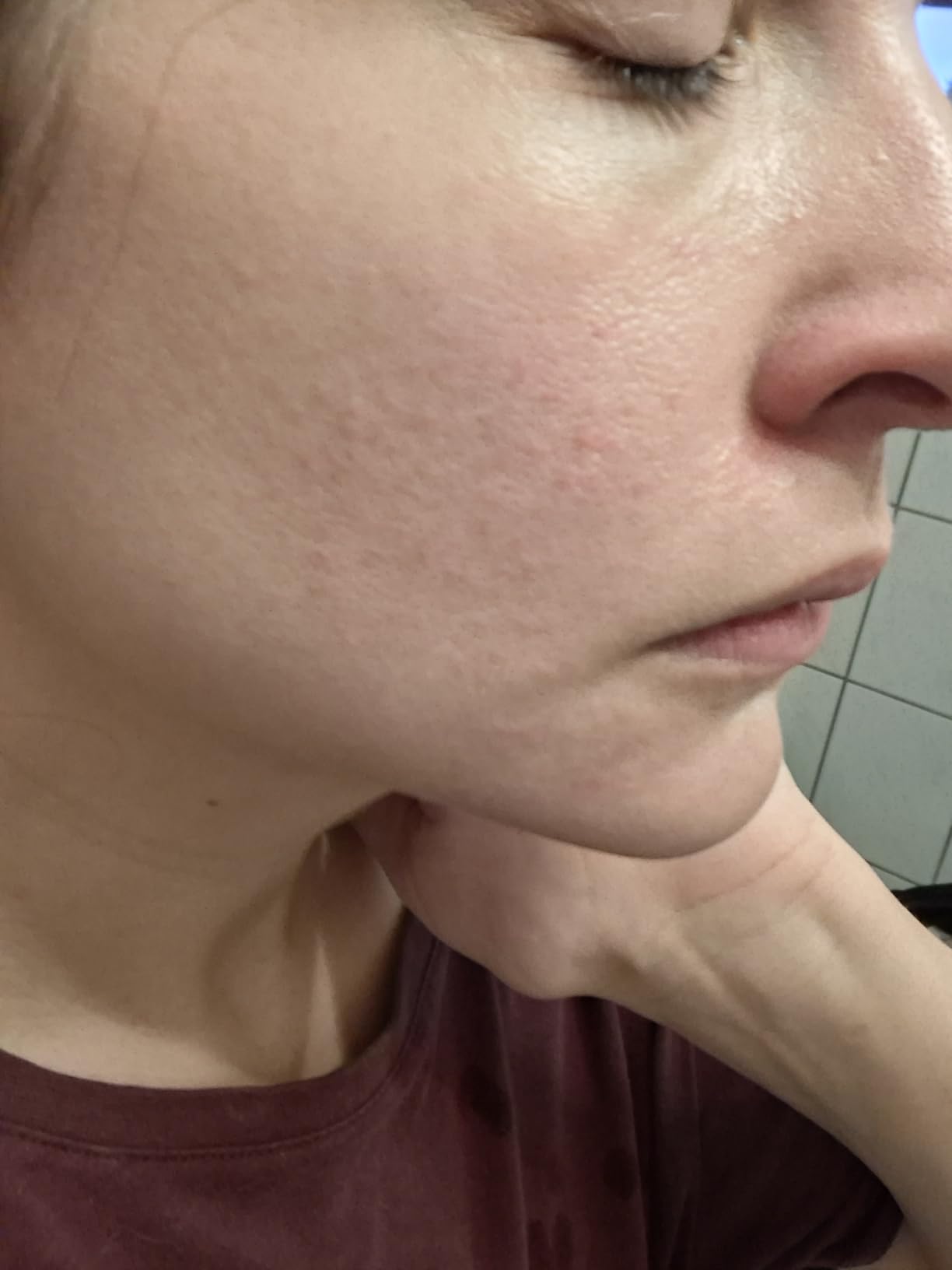 Ottimo per la mia rosacea