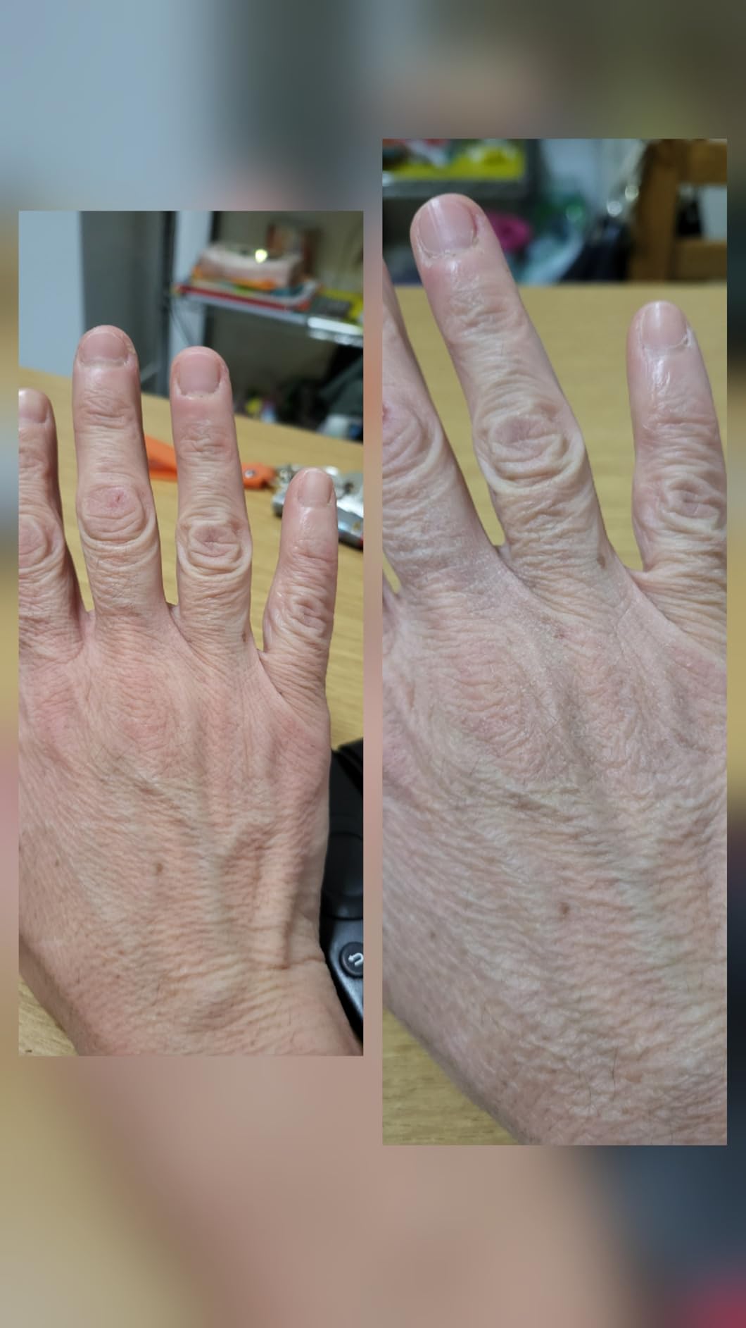Buona ma non mi ha curato le mani come speravo